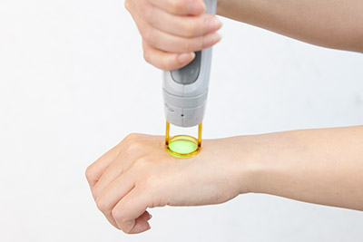 照射時のイメージ写真